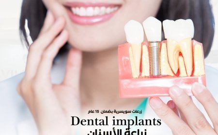 زراعة الأسنان السويسرية في دبي – استثمار طويل الأمد في ابتسامتك