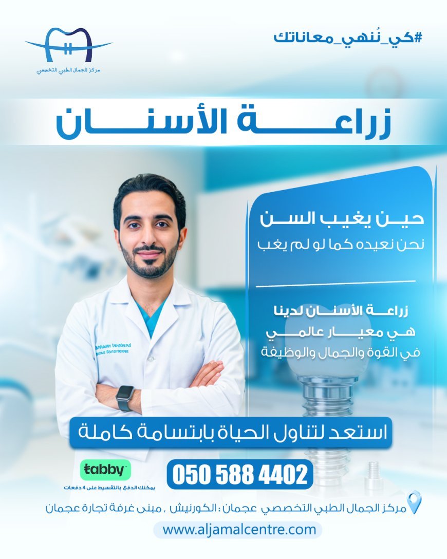 زراعة الأسنان في الإمارات: رحلة استعادة الابتسامة والثقة